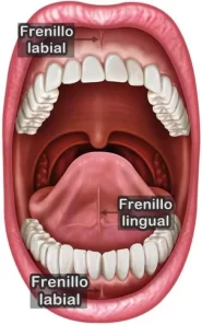 frenillo-labial-y-frenillo-lingual